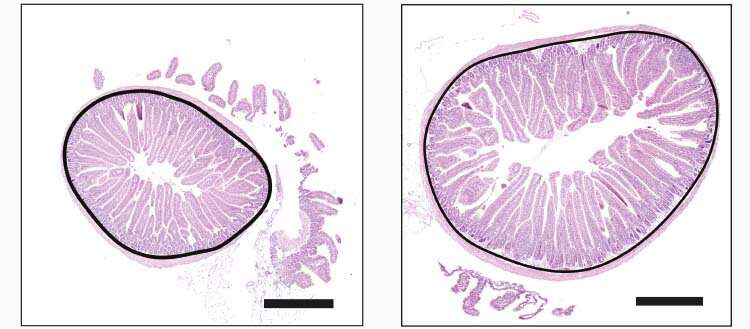 How food intake modifies the gut - Communiqués de presse