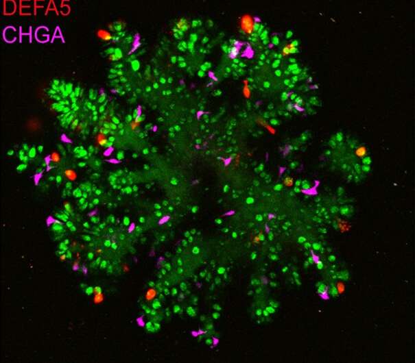 Optimization of human small intestinal organoids