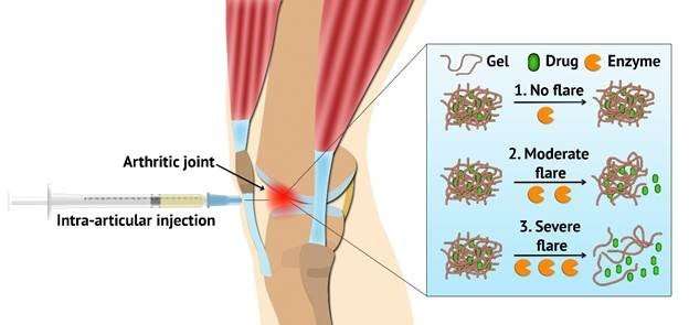 Flare-responsive hydrogel developed to treat arthritis 