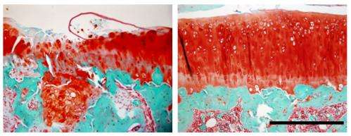 New theory on genesis of osteoarthritis comes with successful therapy in mice 