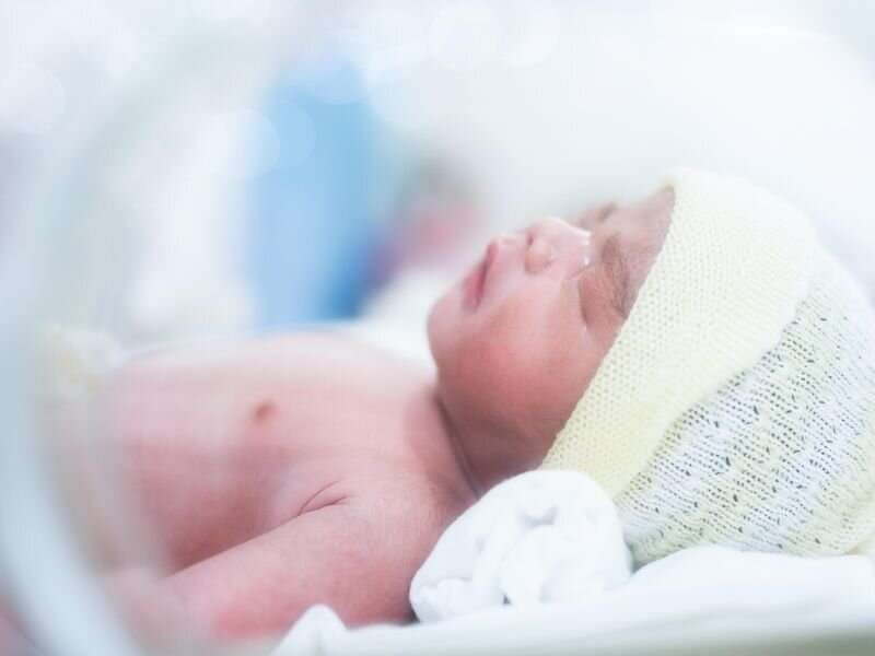 Guideline updated for managing hyperbilirubinemia in newborns