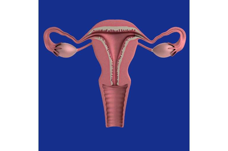 Research finds removing ovaries at benign hysterectomy carries health risks 