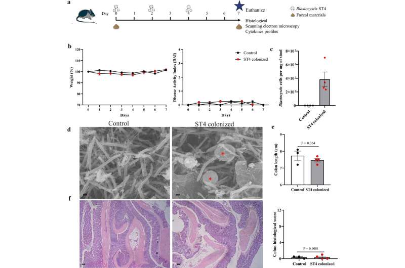 A friend, not foe: Parasite in gastrointestinal system found to promote health 