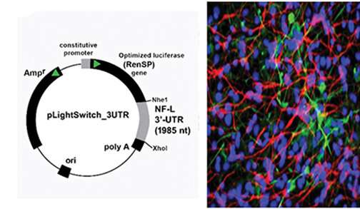 Discovering a major contributor to Alzheimer's disease