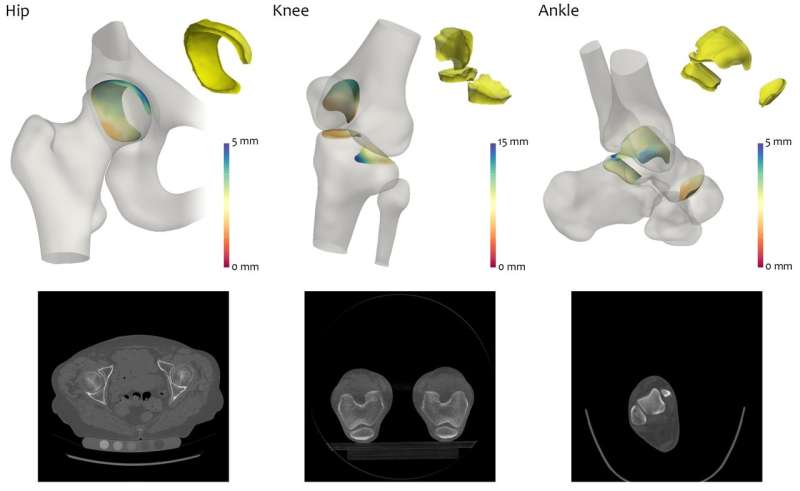 New 3-D imaging analysis technique could lead to improved arthritis treatment 