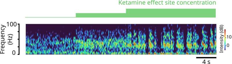 Study models how ketamine's molecular action leads to its effects on the brain