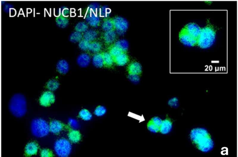 Researchers identify promising protein candidate for metabolic disease treatment