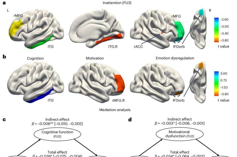 One in two children with ADHD experience emotional problems, study finds