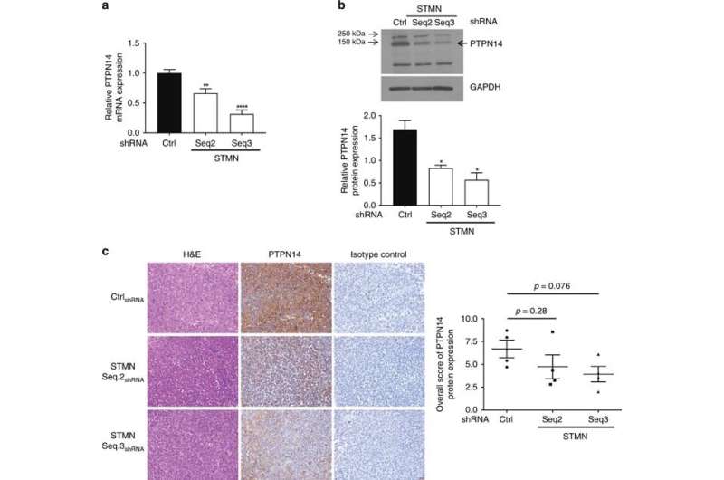 Research sheds important light on the metastasis of neuroblastoma