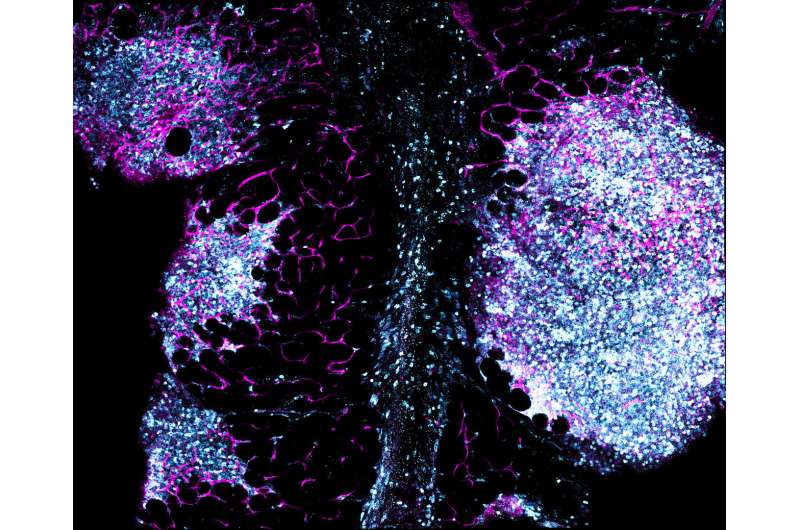 Fatty tissue surrounding intestinal tracts of mice found to help eject gut-infesting worms