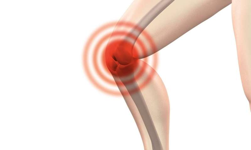 Workload linked with an increased risk of knee osteoarthritis 