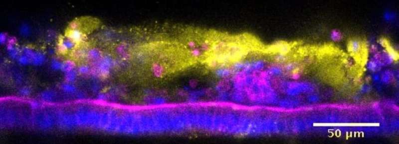 Of mice and men and their different tolerance to pathogens