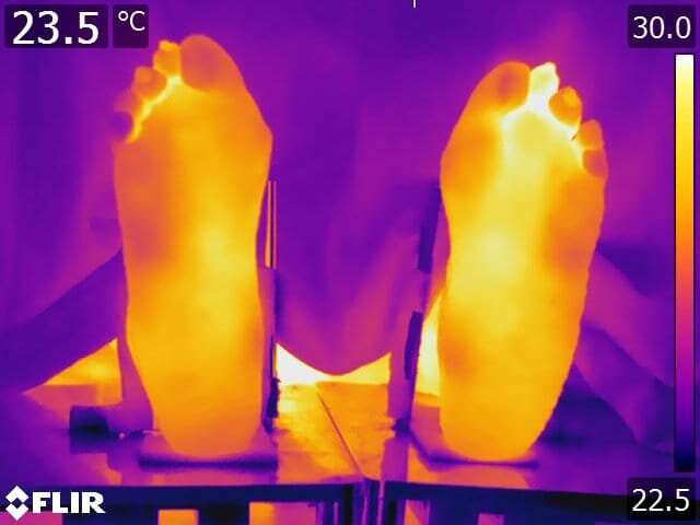 Higher body temperatures still a factor in patients in remission from rheumatoid arthritis 