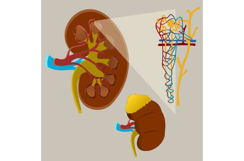 Analysis links impaired kidney function with cognitive disorders  