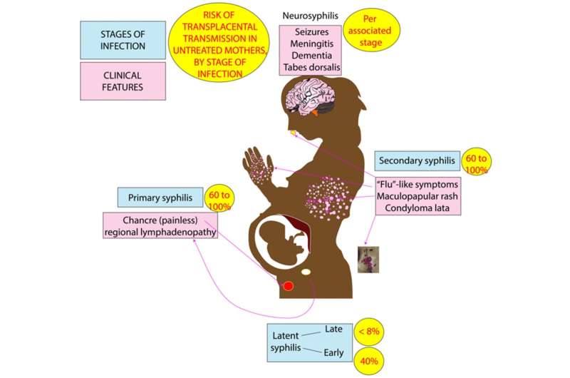 The rising health crisis of congenital syphilis: What physicians can do 