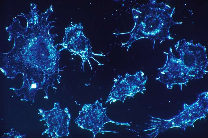 Researchers find new way to target childhood cancer 