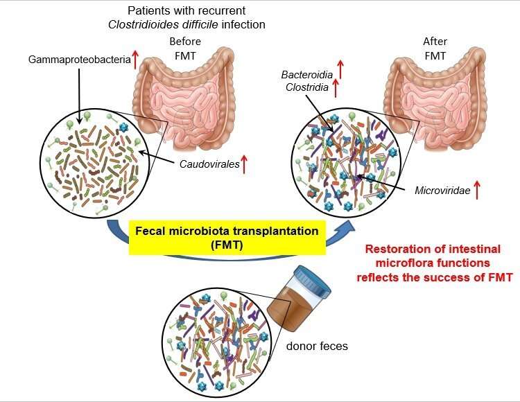 Scientists reveal mechanism behind fecal microbiota transplantation 