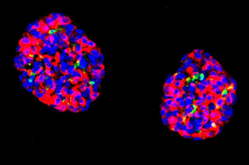 Scientists target human stomach cells for diabetes therapy