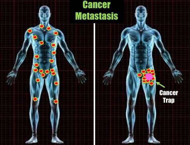 Researcher patents 'roach motel' for cancer 