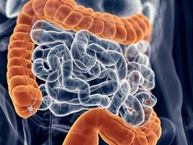 Colorectal cancer screening should start at age 45 years