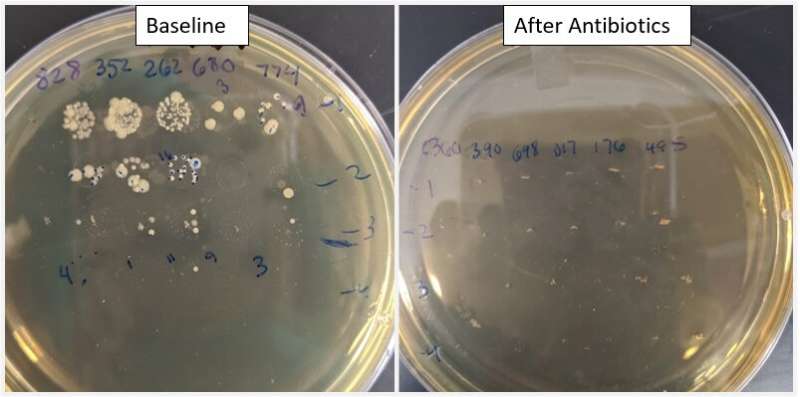 Antibiotics wreak havoc on athletic performance