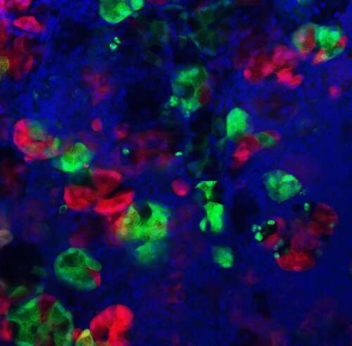 Uncovering how injury to the pancreas impacts cancer formation 