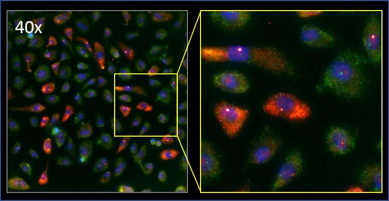 Researchers develop techniques to track the activity of a potent cancer gene 