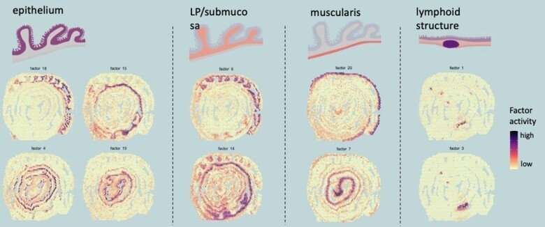 Colonic gene mapping gives insights into intestinal diseases