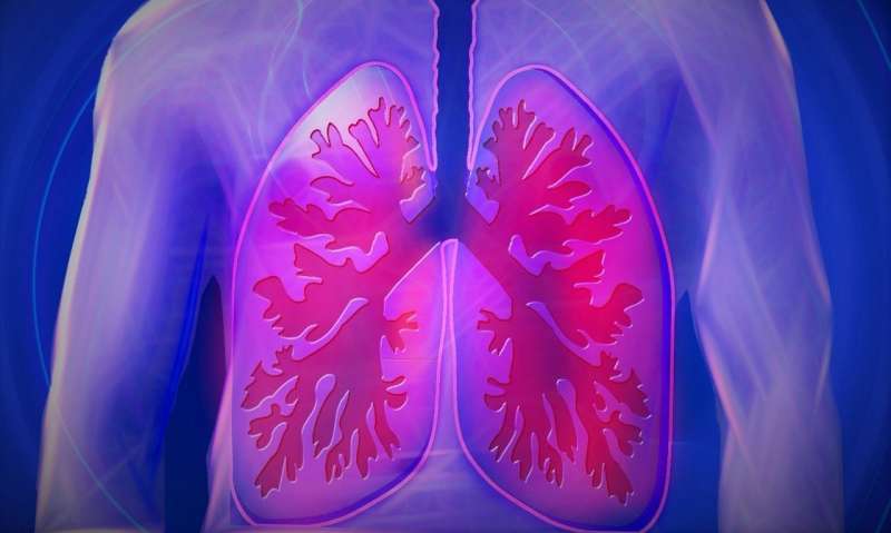 Researchers characterize lung inflammation associated with some cancer immnunotherapy 