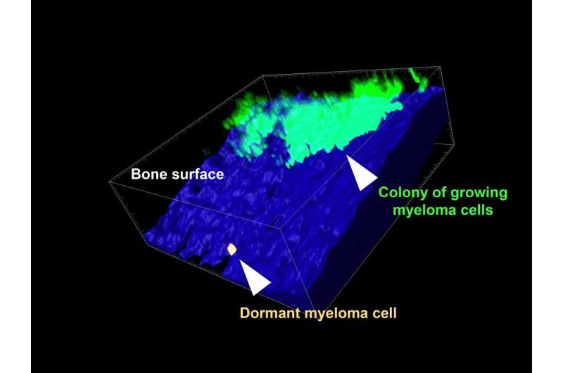 Researchers reveal key to targeting dormant cancer cells