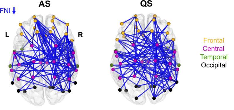 Brain development of the preterm baby is improved by supporting emotional connection with the parent