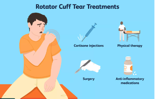 What Is a Rotator Cuff Tear?