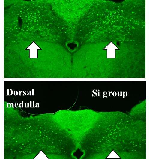 Hydrogen generated by Si-based agent attenuates inflammation in ulcerative colitis mouse model