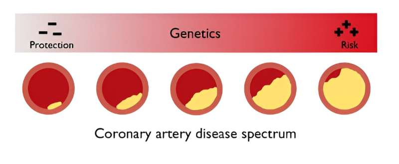 New AI tool finds rare variants linked to heart disease in 17 genes