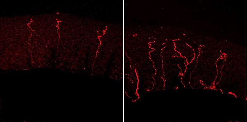 Researchers discover a protein that prunes nerve endings, regulating sensitivity to pain 