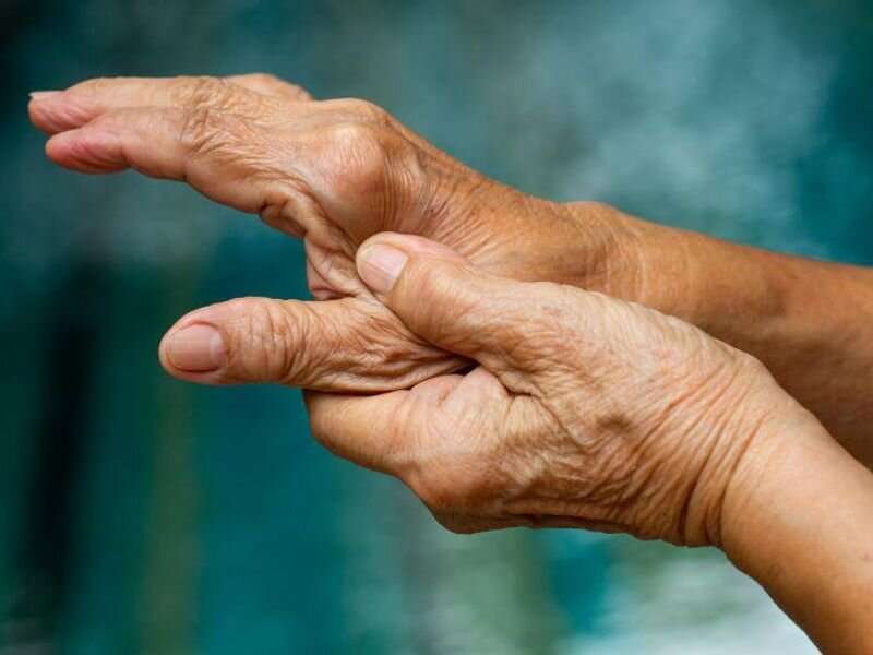 Prevalence of multimorbidity up in rheumatoid arthritis 