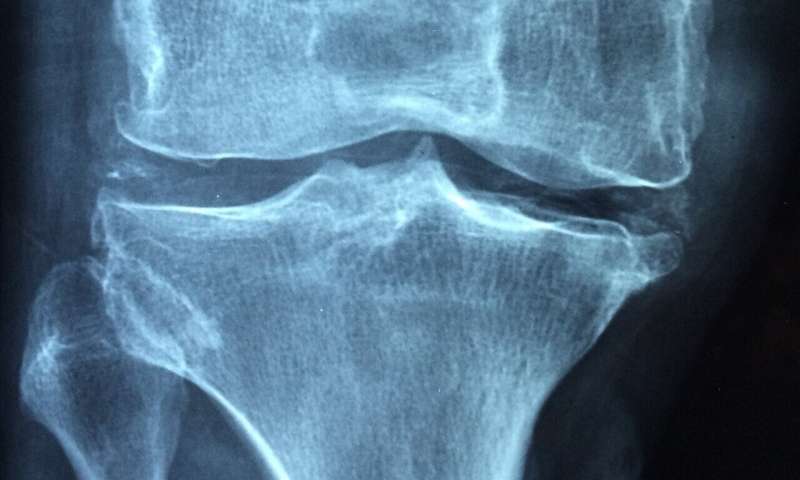 Comparison between major types of arthritis based on diagnostic ultrasonography 