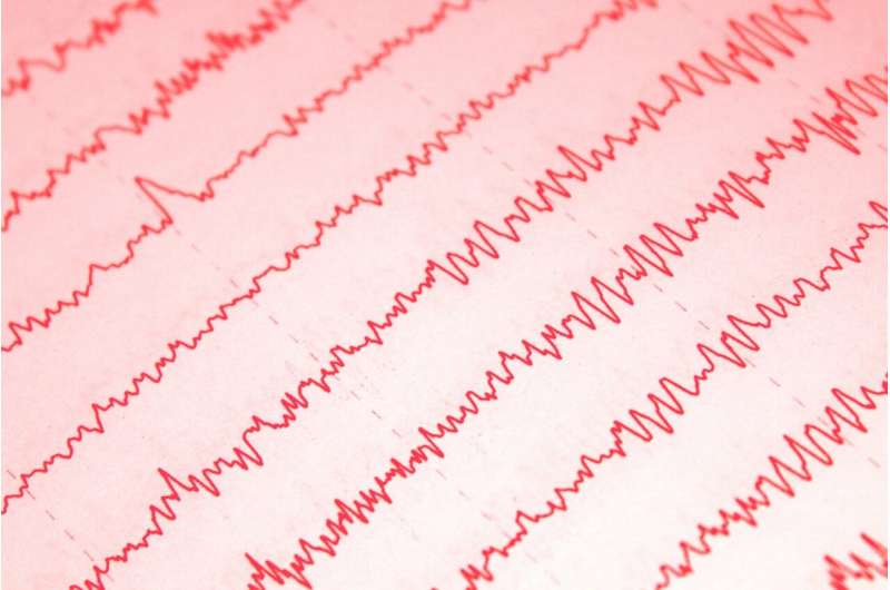 Trial finds preventive epilepsy treatment with vigabatrin does not improve neurocognitive development in TSC infants 