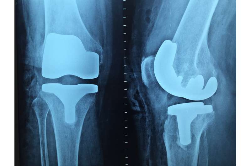 knee x-ray