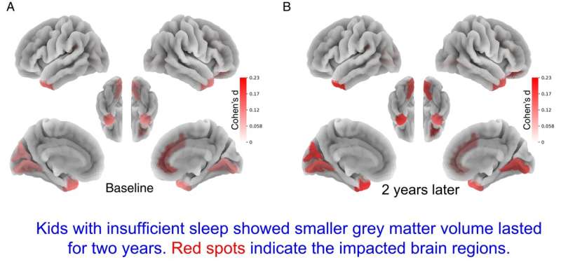 Children who lack sleep may experience detrimental impact on brain and cognitive development that persists over time 