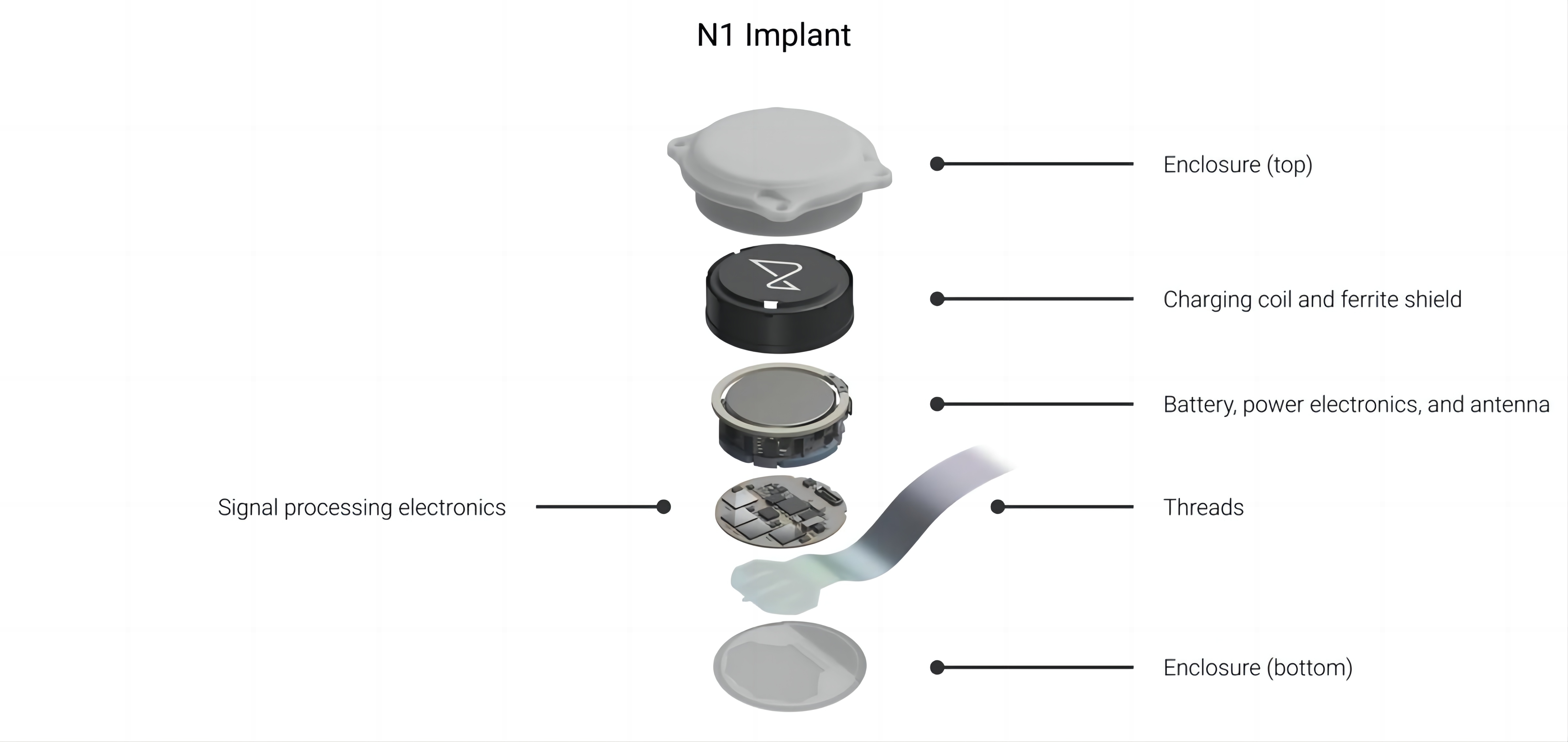 n1_implant_exploded