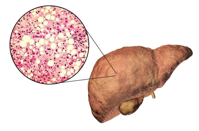 Osteopontin, a protein not always as bad as it is made out to be