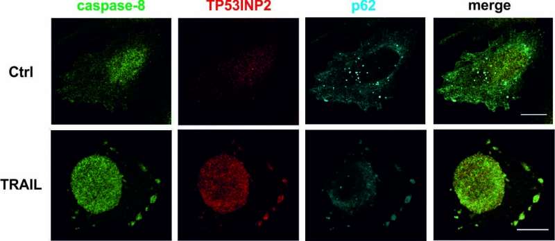 Researchers identify a new biomarker for personalised treatments against cancer 