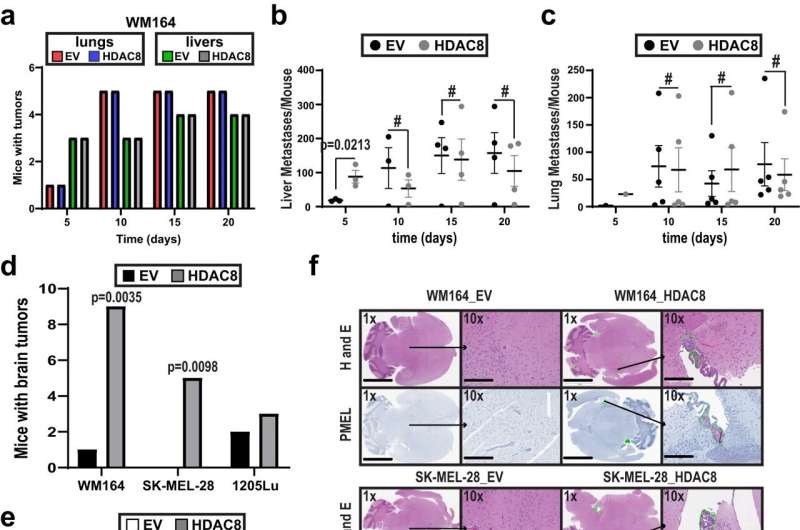 Researchers identify cell signaling pathways controlling melanoma cell metastasis to the brain 