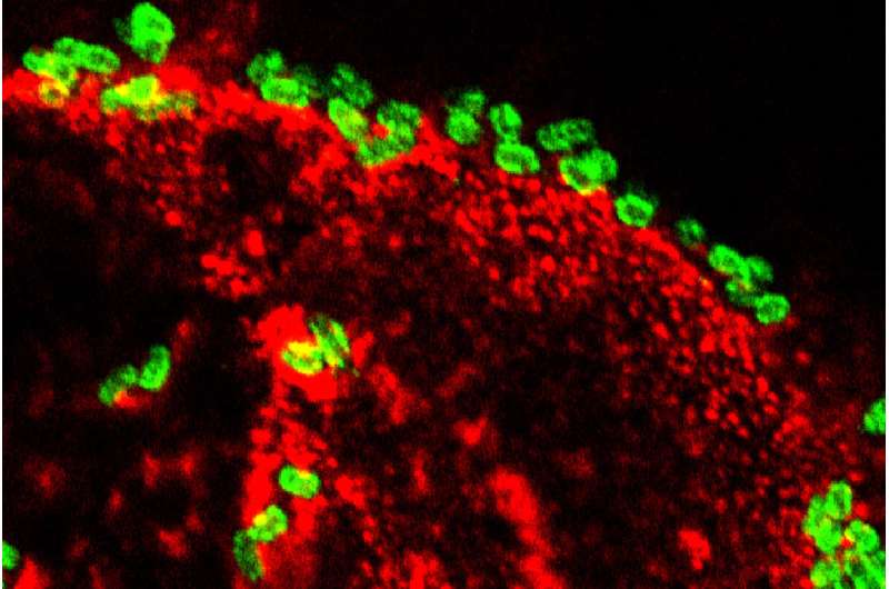 Toxin provides clues to long-term effects of diarrhea caused by E. coli