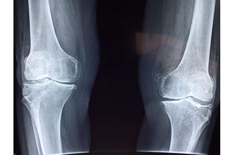 Updated guideline introduces new recommendations for use of medications around total hip and knee replacement 