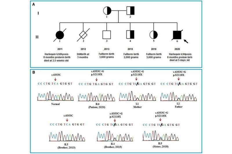 Novel rare skin mutation gene identified by whole exome sequencing 