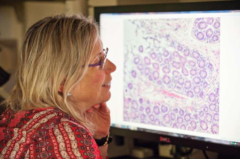 Study: Aggressive breast cancers store large amounts of energy, which enables it to spread