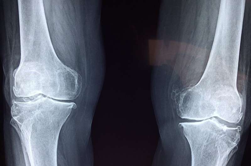 knee cartilage