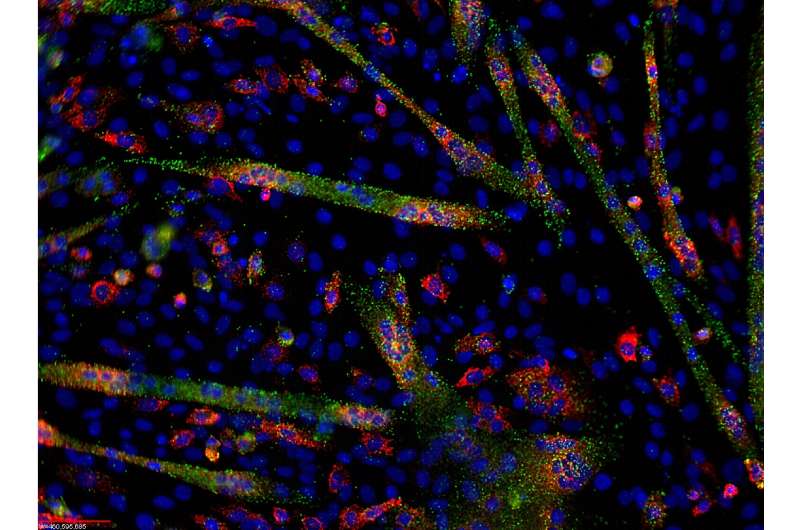 MicroRNA